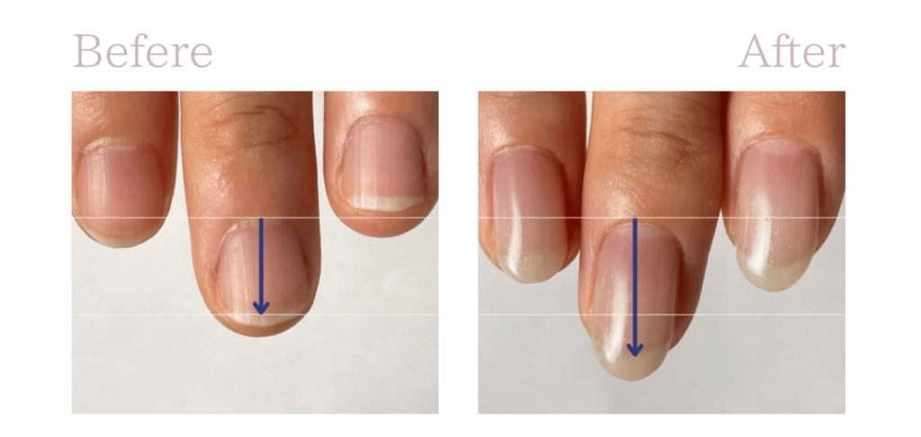 自爪育成ケアのビフォーアフターです